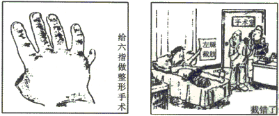 仔细观察下面《给六指做整形手术》和《截错了》两幅漫画